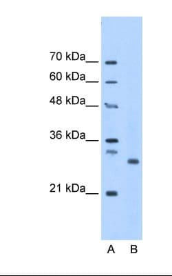 PSMC3IP Antibody (aa143-192)