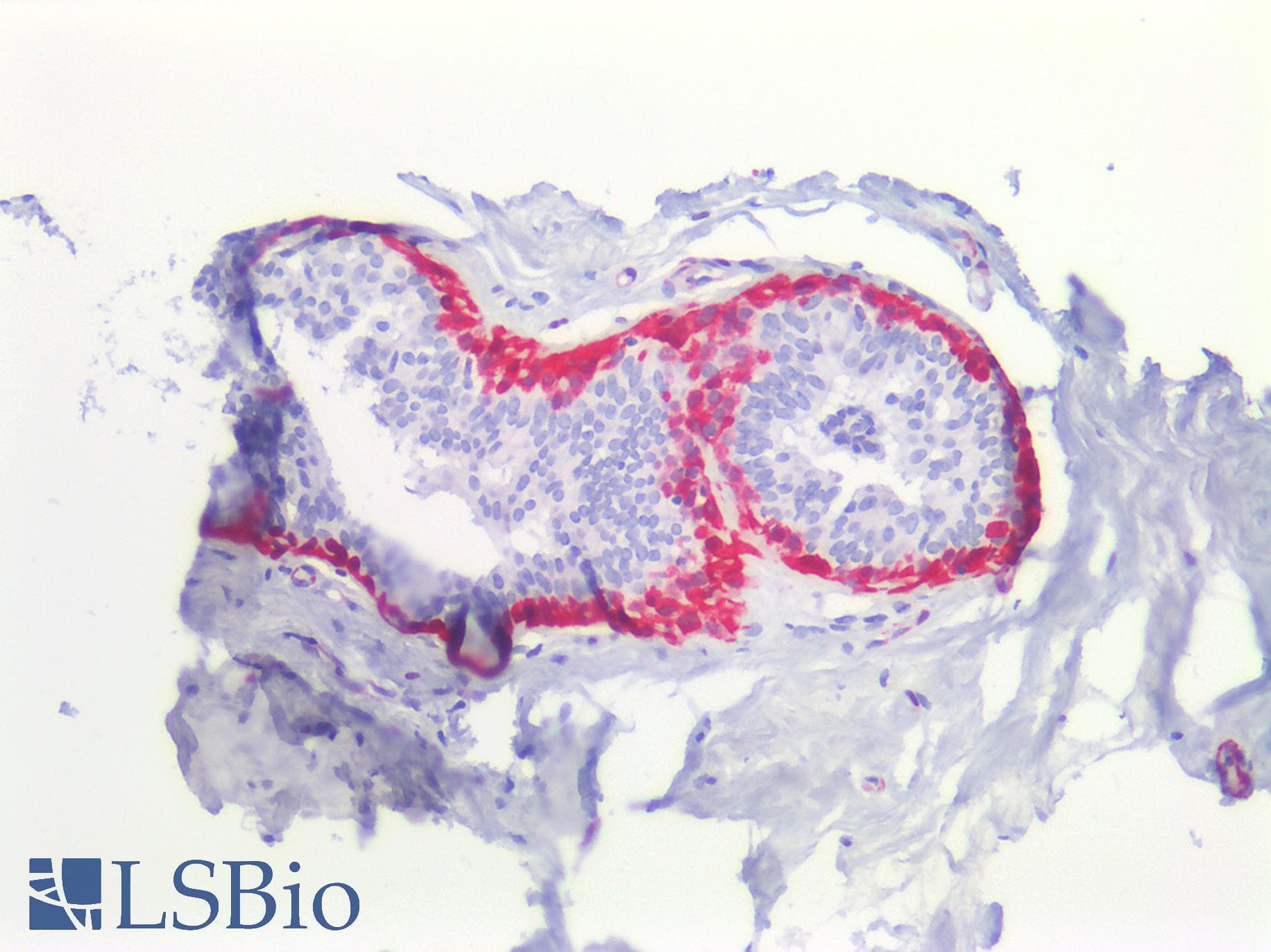 IHC-plus™ Polyclonal Rabbit anti-Human TAGLN / Transgelin / SM22 Antibody (IHC, IF, WB)