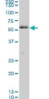 SMAD1 Antibody (clone 1D3)