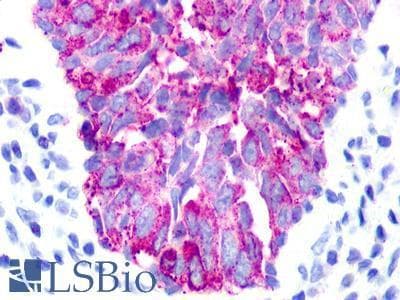 IHC-plus™ UTS2R / GPR14 Antibody (Cytoplasmic Domain)
