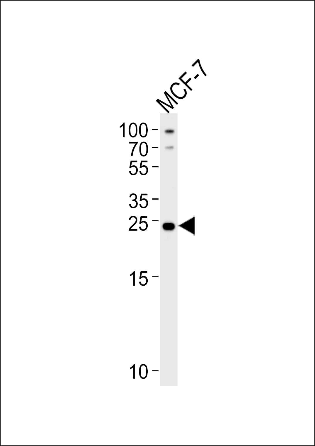 HACD2 / PTPLB Antibody (aa226-254)