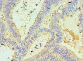 GORASP1 / GRASP65 Antibody (aa221-440)