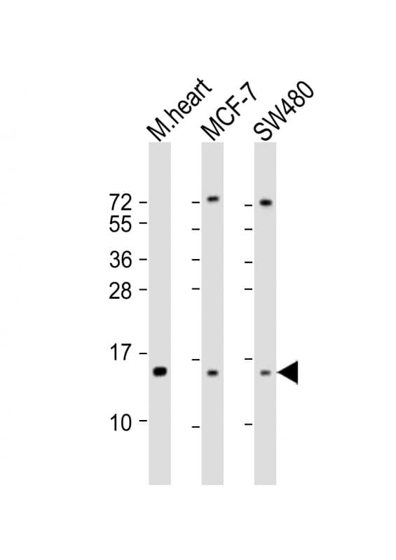 Polyclonal Rabbit anti-Human NDUFA7 Antibody (aa80-110, WB)