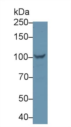 PYGL Antibody (aa341-509)