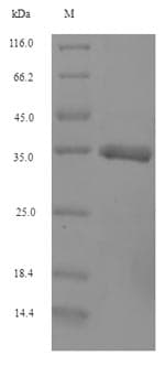 Cow IFNAG Protein (Recombinant 6His-SUMO, N-terminus)