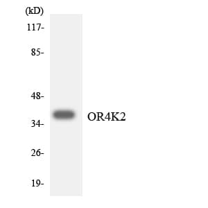 Polyclonal Rabbit anti-Human OR4K2 Antibody (aa257-306, WB)