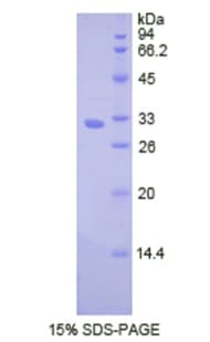 Human CTSV / Cathepsin V Protein (Recombinant His)