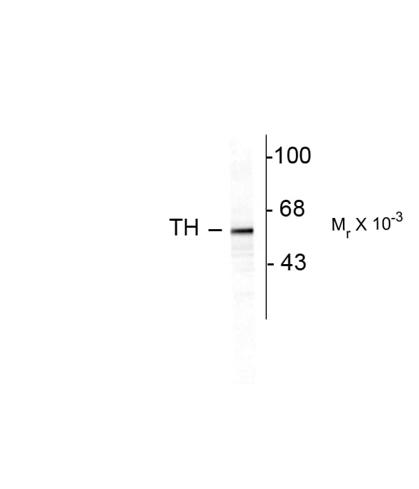 TH / Tyrosine Hydroxylase Antibody