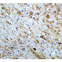 NSMF / NELF Antibody