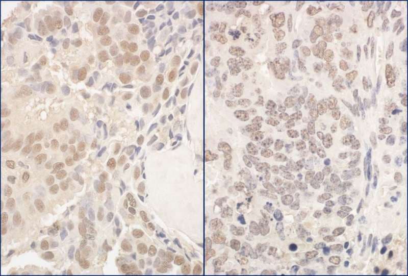 Polyclonal Rabbit anti-Human PUF60 Antibody (aa509-559, IHC, WB)