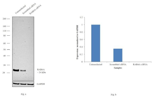 Monoclonal Mouse anti-Human RAB4A / RAB4 Antibody (clone 4E+11, IHC, WB)