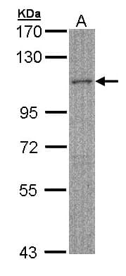 MYBPC2 Antibody (aa411-729)