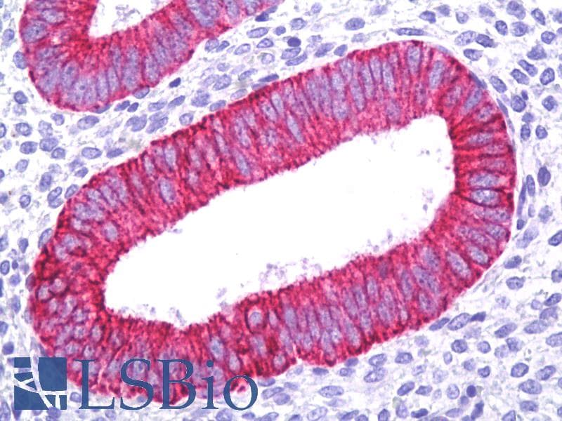 PathPlus™ Polyclonal Rabbit anti-Human KRT18 / CK18 / Cytokeratin 18 Antibody (IHC, IF, WB)