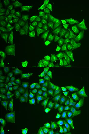 ASL / Argininosuccinate Lyase Antibody