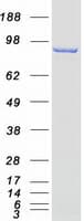 Human EPS8 Protein (Recombinant Myc-DDK (Flag))