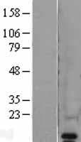 VAMP8 / VAMP-8 Protein (Over-Expression Lysate Myc-DDK (Flag))