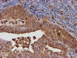 PSMB9 Antibody (clone OTI3F3)