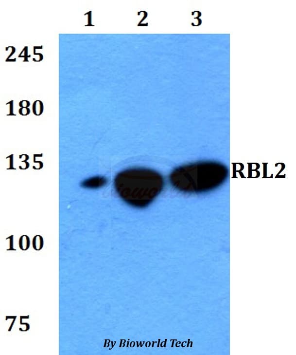 RBL2 / RB2 p130 Antibody