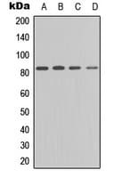 PRKCE / PKC-Epsilon Antibody (C-Terminus)