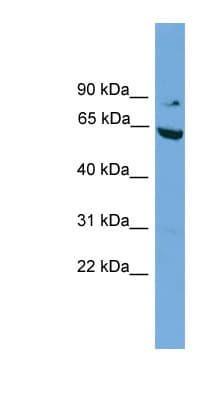 RIP1 / RALBP1 Antibody (N-Terminus)