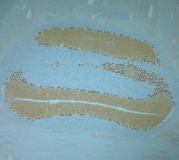 Polyclonal Rabbit anti-Human ITPR1 / IP3 Receptor Type 1 Antibody (aa700-750, IHC)