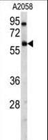 USP14 Antibody (aa1-30)
