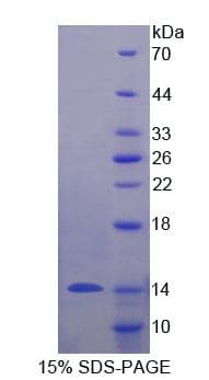 Human MUC3B Protein (Recombinant His-T7)