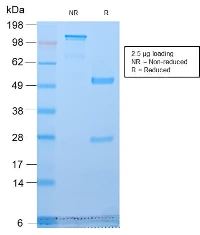 Recombinant Monoclonal Rabbit anti-Human Golgi Zone Antibody (clone GLG1/2829R, IHC)