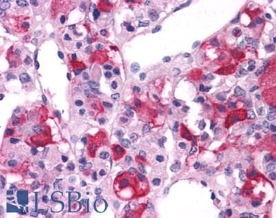 PathPlus™ GRM3 / MGLUR3 Antibody (N-Terminus)