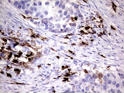 Monoclonal Mouse anti-Human S100A9 / MRP14 Antibody (clone UMAB173, Carrier-free, IHC, IF, WB)