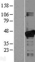 MAP2K3 / MEK3 / MKK3 Protein (Over-Expression Lysate Myc-DDK (Flag))