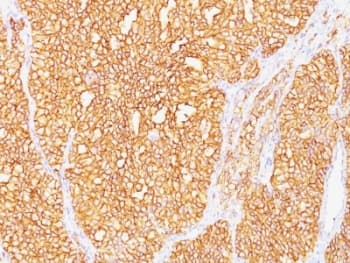 CA9 / Carbonic Anhydrase IX Antibody (clone SPM487)