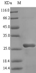 Pyrococcus furiosus Alba Protein (Recombinant 6His-SUMO, N-terminus)