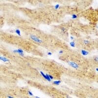 L2HGDH Antibody