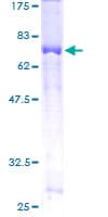 Human TRIP13 Protein (Recombinant GST)