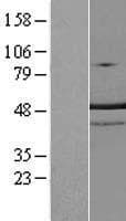 TRNT1 / CCA1 Protein (Over-Expression Lysate Myc-DDK (Flag))