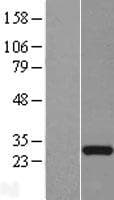 Human CTA-216E10.6 Protein (Over-Expression Lysate Myc-DDK (Flag))