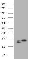 NME1 / NM23 Antibody (clone OTI1H4)
