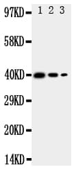 TRAM2 Antibody (aa309-325)