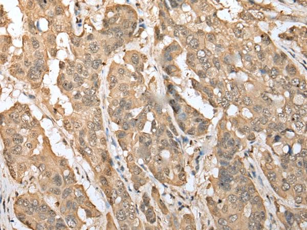 ZNF672 Antibody