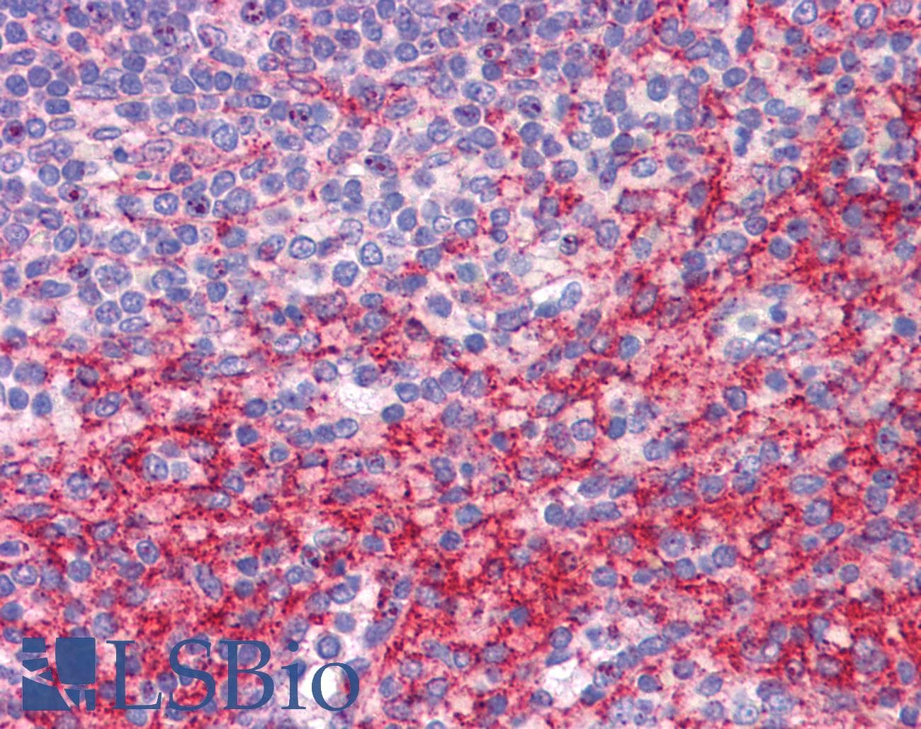 IHC-plus™ Polyclonal Rabbit anti-Human ATG9B Antibody (IHC, IF, WB)