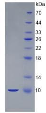 Mouse S100B / S100 Beta Protein (Native His, N-Terminal)