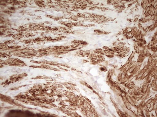 SP110 Antibody (aa232-521, clone OTI1C3)