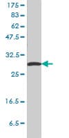 IHC-plus™ Monoclonal Mouse anti-Human SFN / Stratifin / 14-3-3 Sigma Antibody (clone 3C3, IHC, WB)