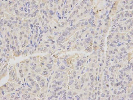 Polyclonal Rabbit anti-Human EMD / Emerin Antibody (IHC, IF, WB)