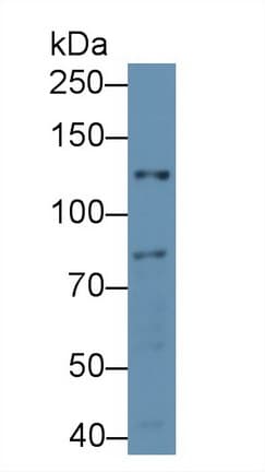 NOS2 / iNOS Antibody (aa868-909)