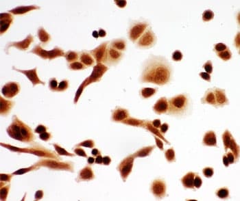 TP63 / p63 Antibody (aa664-680)