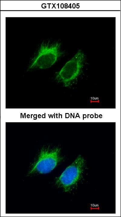 INHBA / Inhibin Beta A Antibody (aa362-426)
