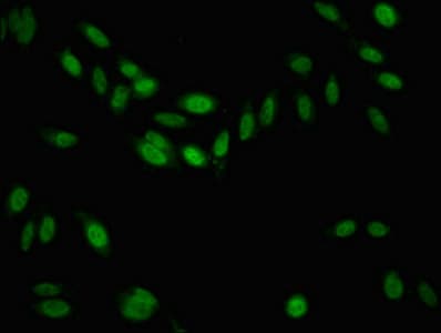 KDM6B / JMJD3 Antibody