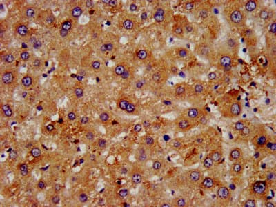 Polyclonal Rabbit anti-Human FGFRL1 Antibody (IHC, IF)